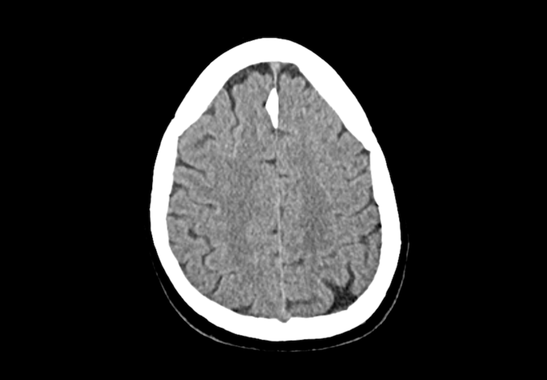 shane-s-brains-ct-scan-september-2023-mcretro